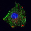 Клетки рака шейки матки человека  - HeLa.jpg
